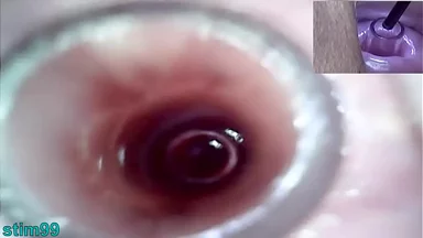 Nữ đồng tính chơi mạnh cổ tử cung và xâm nhập niệu đạo bằng dương vật giả